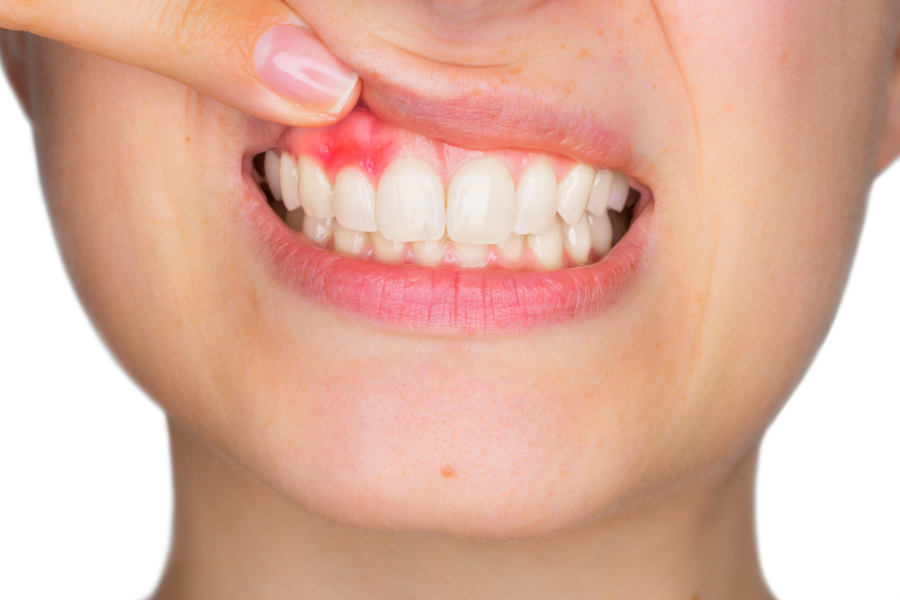 How To Improve Gum Health